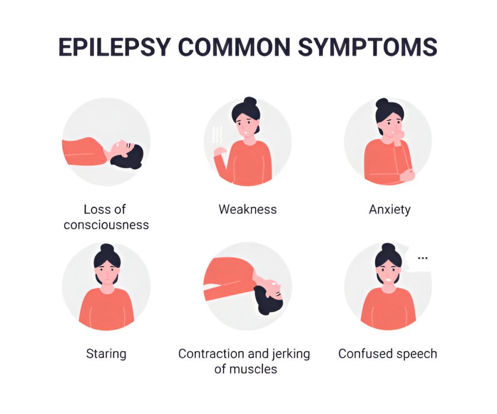 common seizure (epilepsy) symptoms