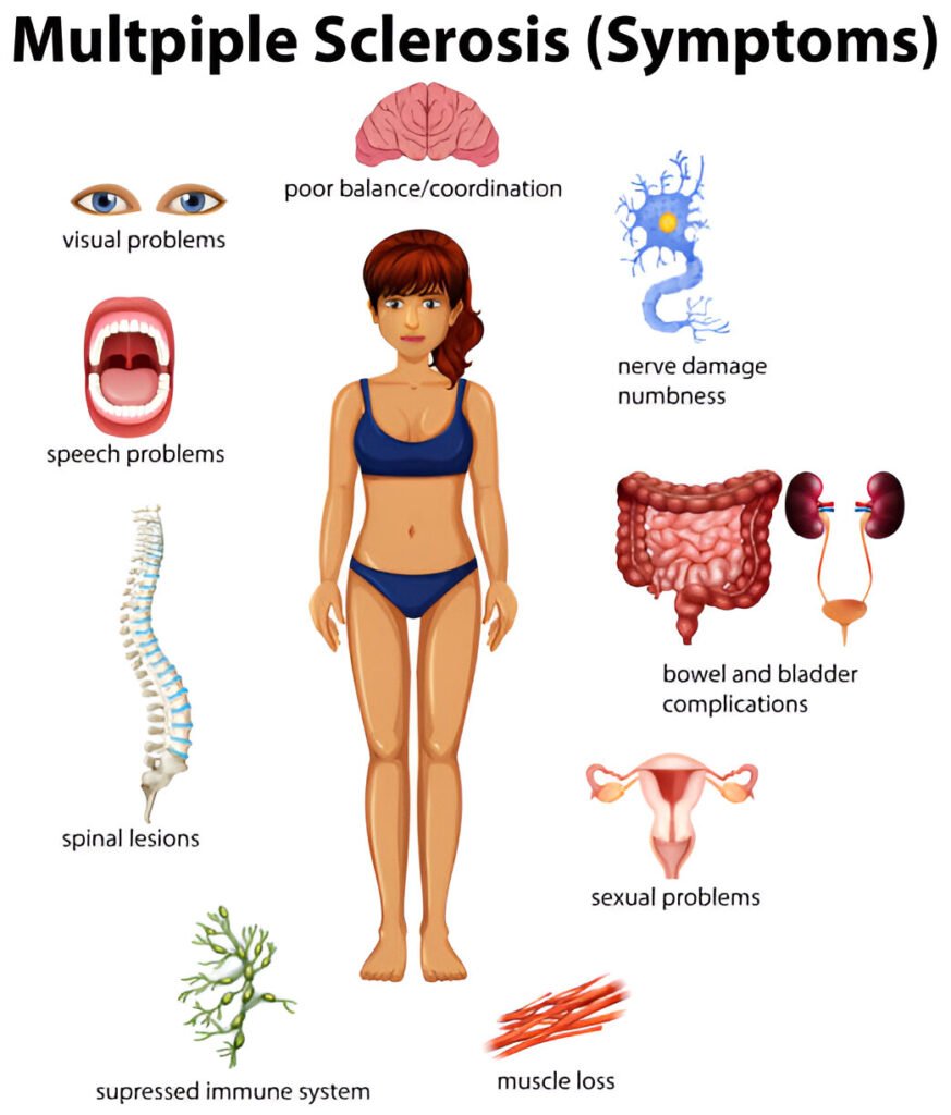 multiple sclerosis (ms) symptoms